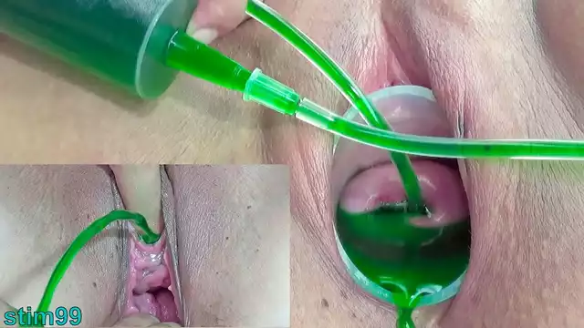 Japanese Lesbian Cervix and Pee Hole Inflation with Injections ~ Exploring New Pleasures